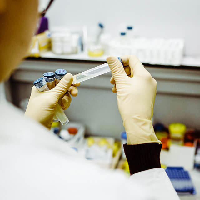 Gloves for laboratory